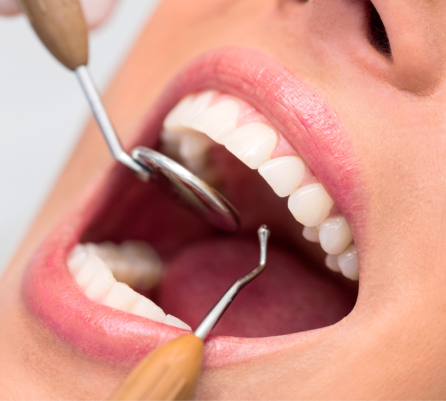 Хирургия зубов